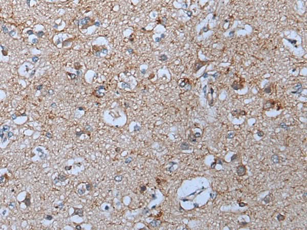 Immunohistochemistry of paraffin-embedded Human brain tissue using YPEL5 Polyclonal Antibody at dilution of 1:60(×200)