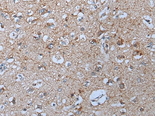 Immunohistochemistry of paraffin-embedded Human brain tissue using YPEL5 Polyclonal Antibody at dilution of 1:60(×200)