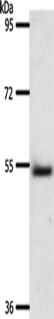 Anti-Human A1BG Antibody - ABMIUM