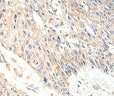 Anti-Human SLC27A1 Antibody - ABMIUM