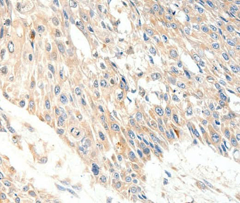 Anti-Human SLC27A1 Antibody - ABMIUM