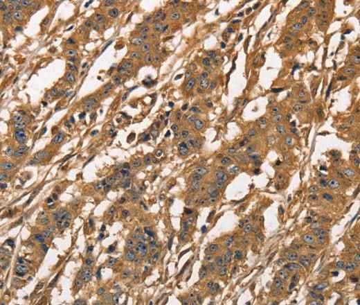 Anti-Human/Mouse/Rat CAPZA3 Antibody