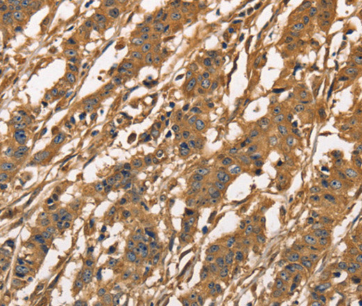 Anti-Human/Mouse/Rat CAPZA3 Antibody - ABMIUM