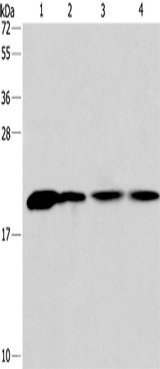 Anti-Human/Mouse/Rat PPIB Antibody - ABMIUM