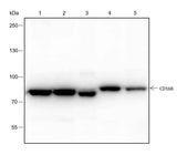 Anti-Human/Rat/Mouse/African green monkey CD168 Antibody [A160]