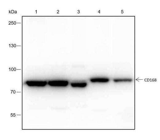 Anti-Human/Rat/Mouse/African green monkey CD168 Antibody [A160] - ABMIUM