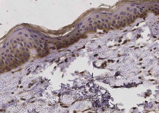 Anti-Human FCGRT & B2M Antibody [B528] - ABMIUM