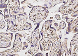 Anti-Human SOD2 Antibody [B179]