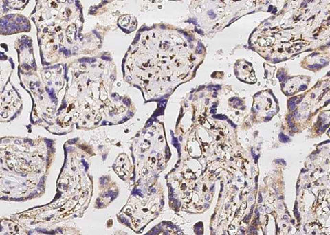 Anti-Human SOD2 Antibody [B179] - ABMIUM