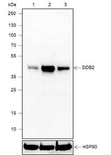 Anti-Human DDB2 Antibody [A636]