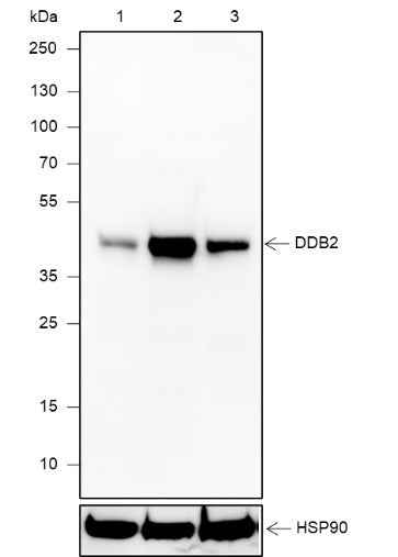 Anti-Human DDB2 Antibody [A636] - ABMIUM