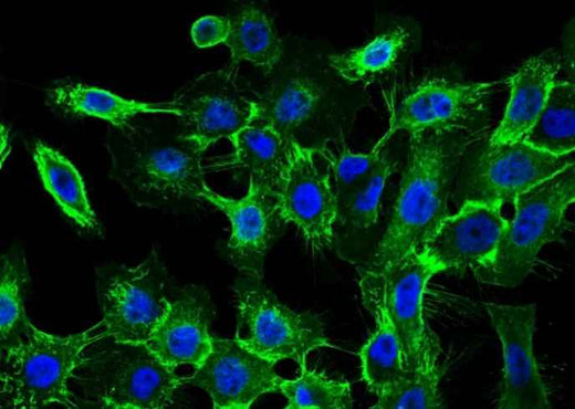 Anti-Human EGFR Antibody [A1118] - ABMIUM