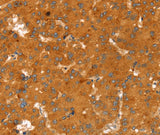 Anti-Human/Mouse/Rat RGS4 Antibody - ABMIUM