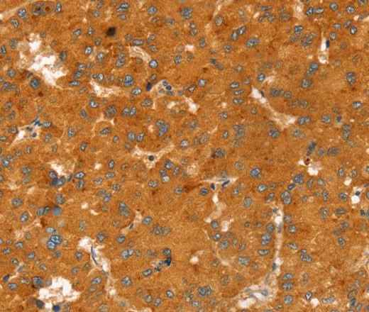 Anti-Human/Mouse/Rat RGS4 Antibody