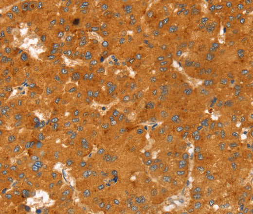 Anti-Human/Mouse/Rat RGS4 Antibody - ABMIUM