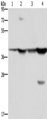 Anti-Human/Mouse FBP1 Antibody - ABMIUM