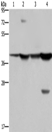 Anti-Human/Mouse FBP1 Antibody - ABMIUM