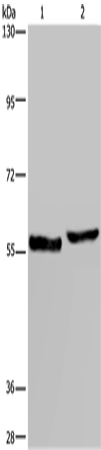 Anti-Human/Mouse/Rat SLC1A6 Antibody - ABMIUM