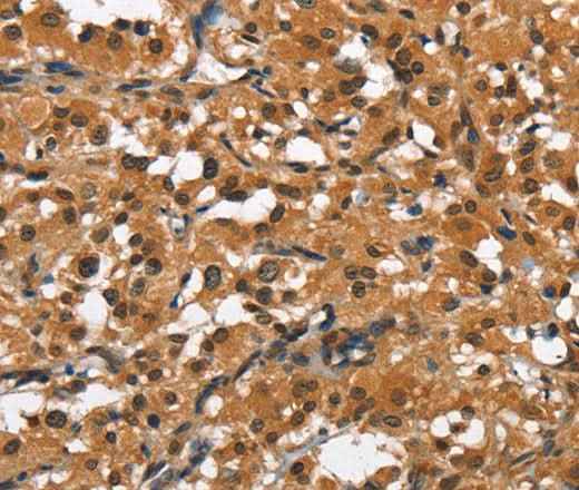 Anti-Human SLAMF8 Antibody
