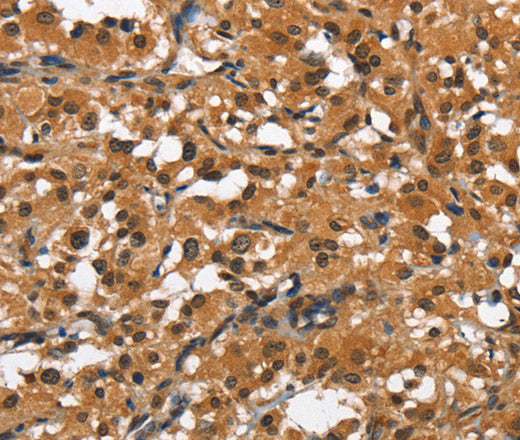 Anti-Human SLAMF8 Antibody - ABMIUM