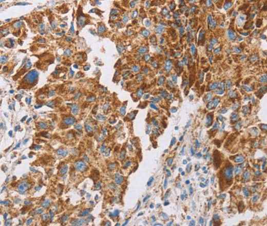 Anti-Human/Mouse/Rat GUCY1A3 Antibody