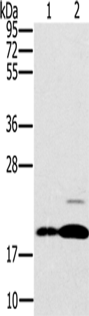 Anti-Human/Mouse/Rat PTP4A2 Antibody - ABMIUM