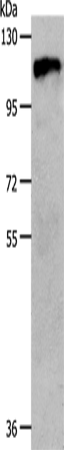 Anti-Human/Mouse/Rat CSF1R Antibody - ABMIUM