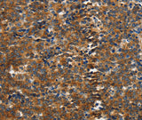 Anti-Human/Mouse/Rat PIK3R4 Antibody - ABMIUM