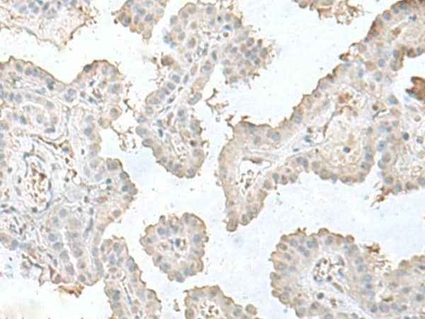 Anti-Human/Mouse LSM10 Antibody