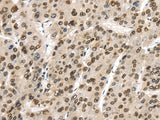 Anti-Human/Mouse/Rat TUSC5 Antibody - ABMIUM