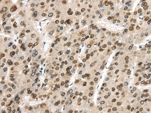 Anti-Human/Mouse/Rat TUSC5 Antibody - ABMIUM