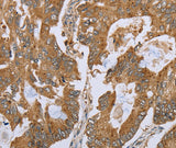 Anti-Human NLRP10 Antibody - ABMIUM
