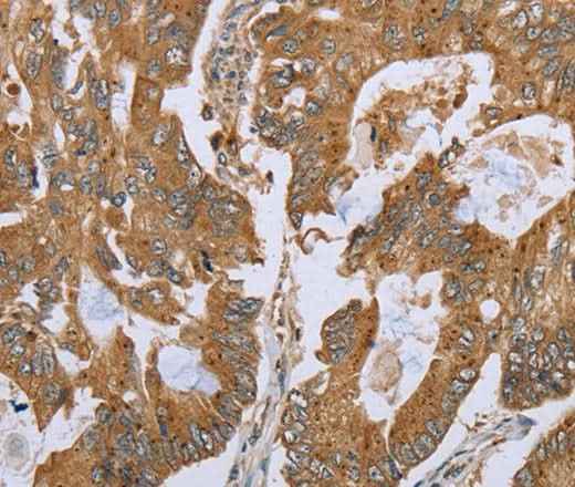 Anti-Human NLRP10 Antibody
