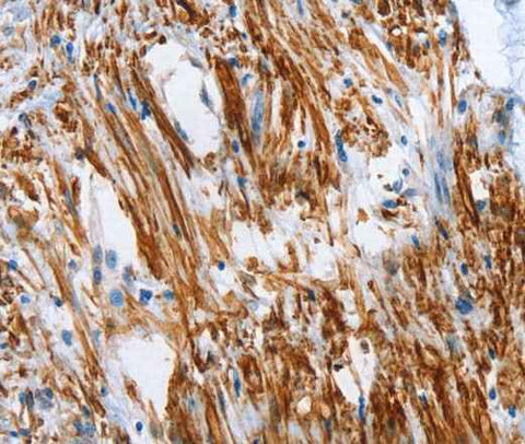 Anti-Human SHROOM2 Antibody