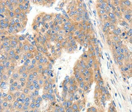 Anti-Human/Mouse COL4A1 Antibody