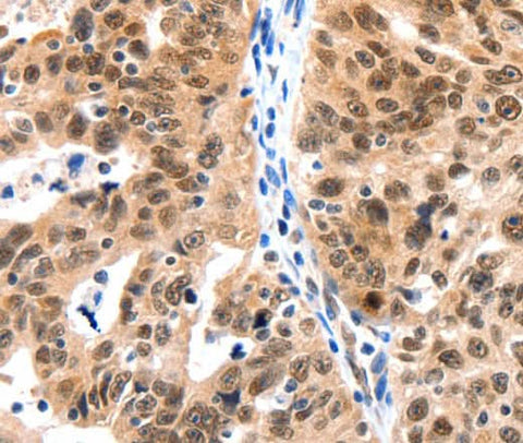 Anti-Human/Mouse LRP5 Antibody - ABMIUM