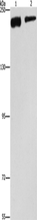 Anti-Human/Mouse/Rat CLTC Antibody - ABMIUM