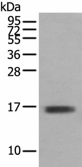 Western blot analysis of Mouse skeletal muscle tissue using TNNC1 Polyclonal Antibody at dilution of 1:400
