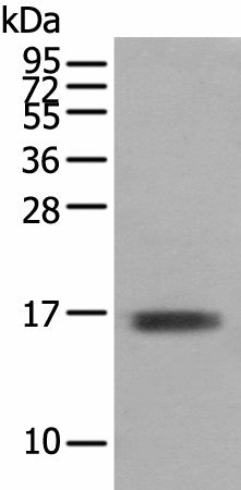 Western blot analysis of Mouse skeletal muscle tissue using TNNC1 Polyclonal Antibody at dilution of 1:400