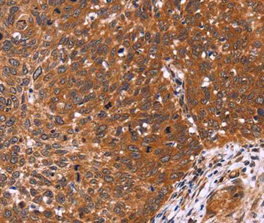 Anti-Human/Mouse/Rat CDC37L1 Antibody