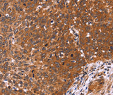 Anti-Human/Mouse/Rat CDC37L1 Antibody - ABMIUM