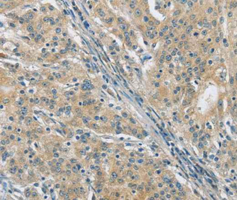 Anti-Human/Mouse PKD1 Antibody