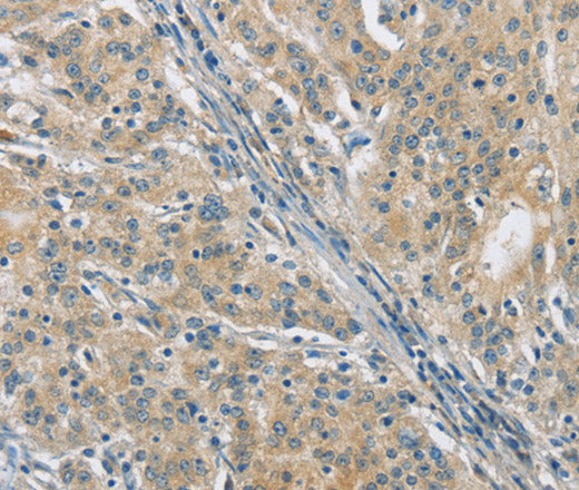 Anti-Human/Mouse PKD1 Antibody - ABMIUM