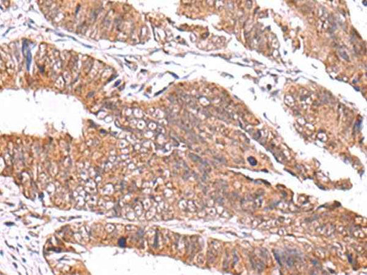 Anti-Human/Mouse/Rat GATM Antibody