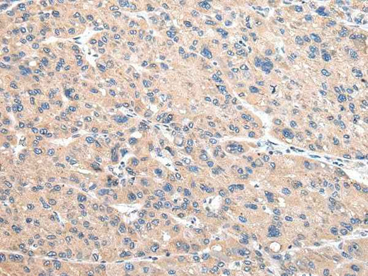 Anti-Human/Mouse VAMP4 Antibody