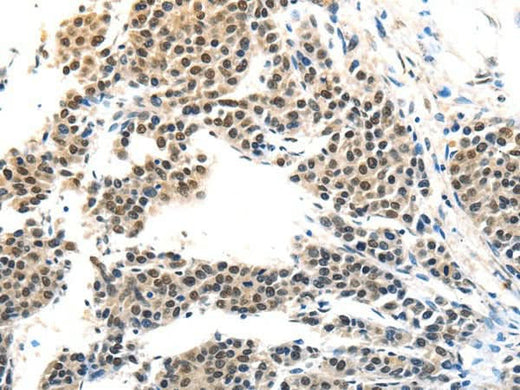 Anti-Human MAGEA6 Antibody - ABMIUM