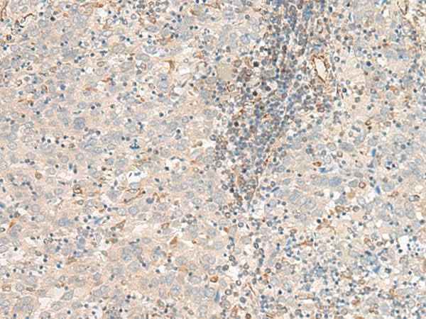 Anti-Human/Mouse/Rat FER Antibody