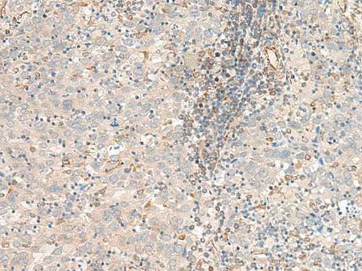 Anti-Human/Mouse/Rat FER Antibody