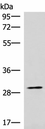 Western blot analysis of Hela cell lysate using CDK4 Polyclonal Antibody at dilution of 1:1000