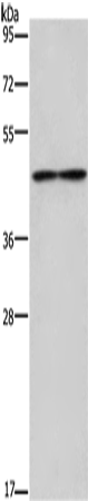 Anti-Human/Mouse IL5RA Antibody - ABMIUM